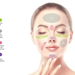MONALISA SOFT/MILD/HARD/ULTRA filler with Lidocaine